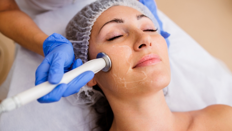 A woman receives a radiofrequency treatment on her face to help reduce wrinkles and improve skin firmness