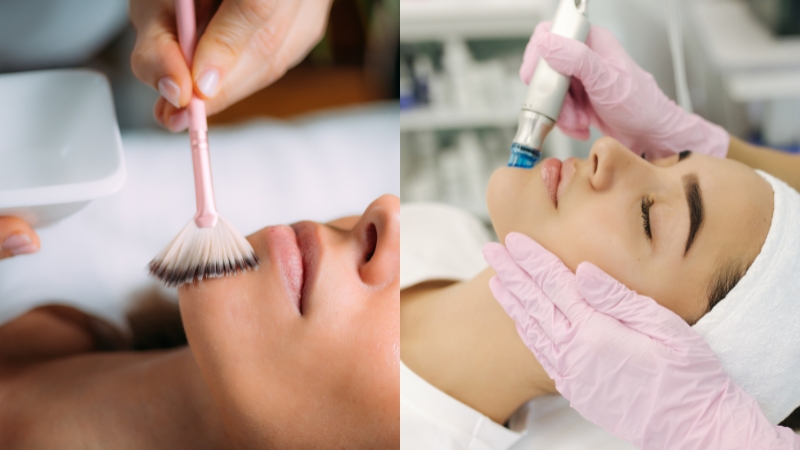 Chemical peel vs. microdermabrasion shown side by side as two different facial treatments