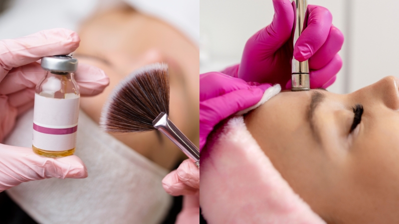 Chemical peel vs. microdermabrasion side by side skin treatments