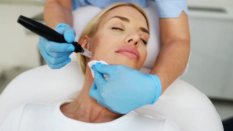A woman receives a professional microneedling treatment on her face with a dermapen device